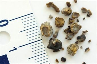 Stones