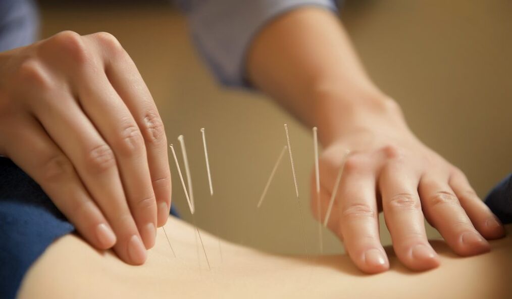 Acupuncture is a common method of treating chronic prostatitis