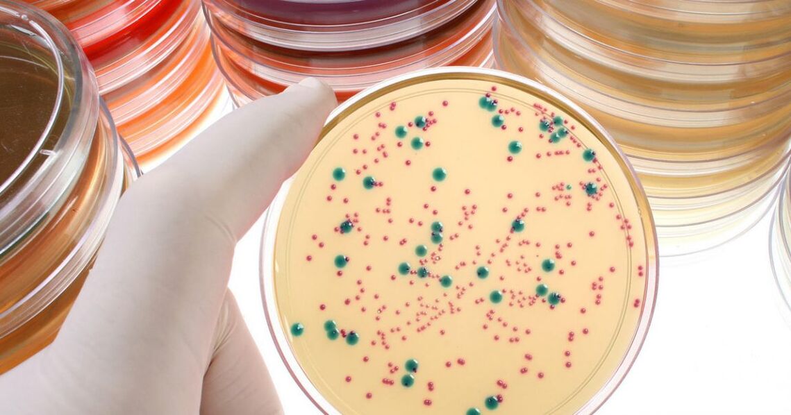Chronic bacterial prostatitis is detected by analysis of urine and prostate secretions